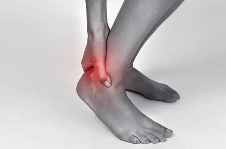 Achilles Tendinopathy
